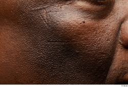 Face Cheek Skin Man Black Scar Overweight Studio photo references